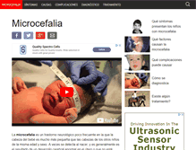 Tablet Screenshot of microcefalia.org